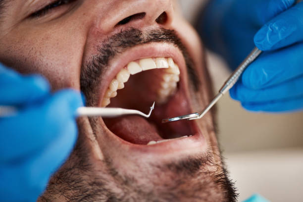 Best Emergency Dental Care for Abscessed Tooth in Parachute, CO